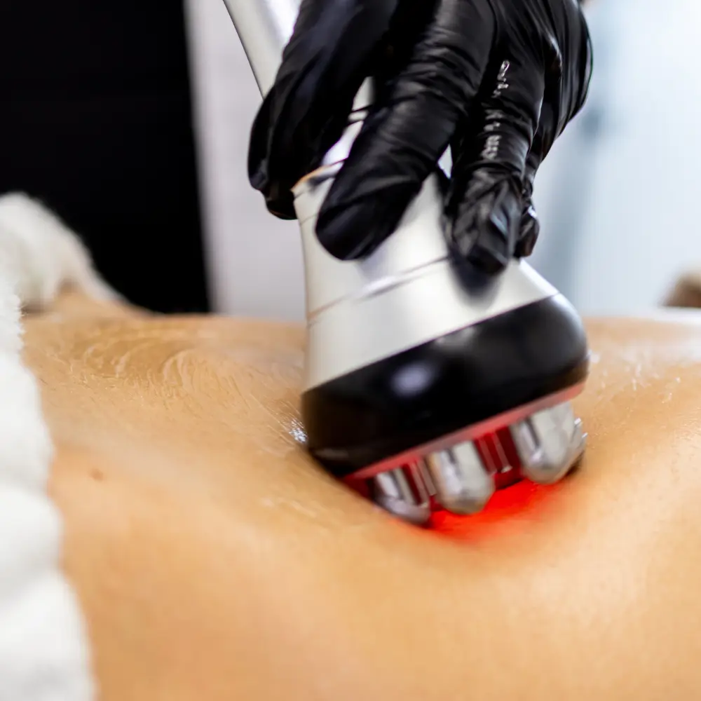 Tête d’appareil de lipocavitation à diodes rouges, tenue par une main gantée, au contact de la peau.